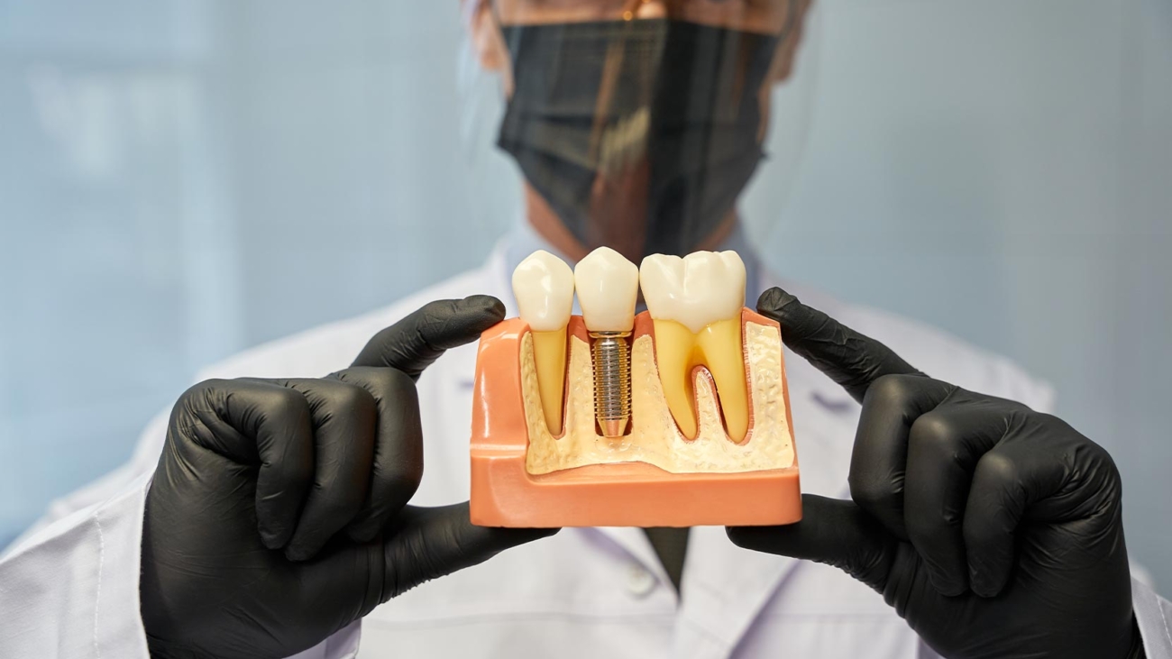 dental-implantlar-gunumuzdeki-son-teknolojik-gelismeler