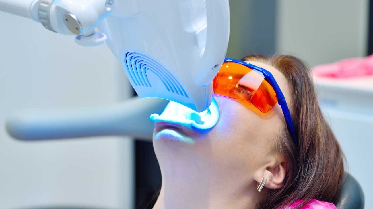 dis-beyazlatma-sonrasi-bakim