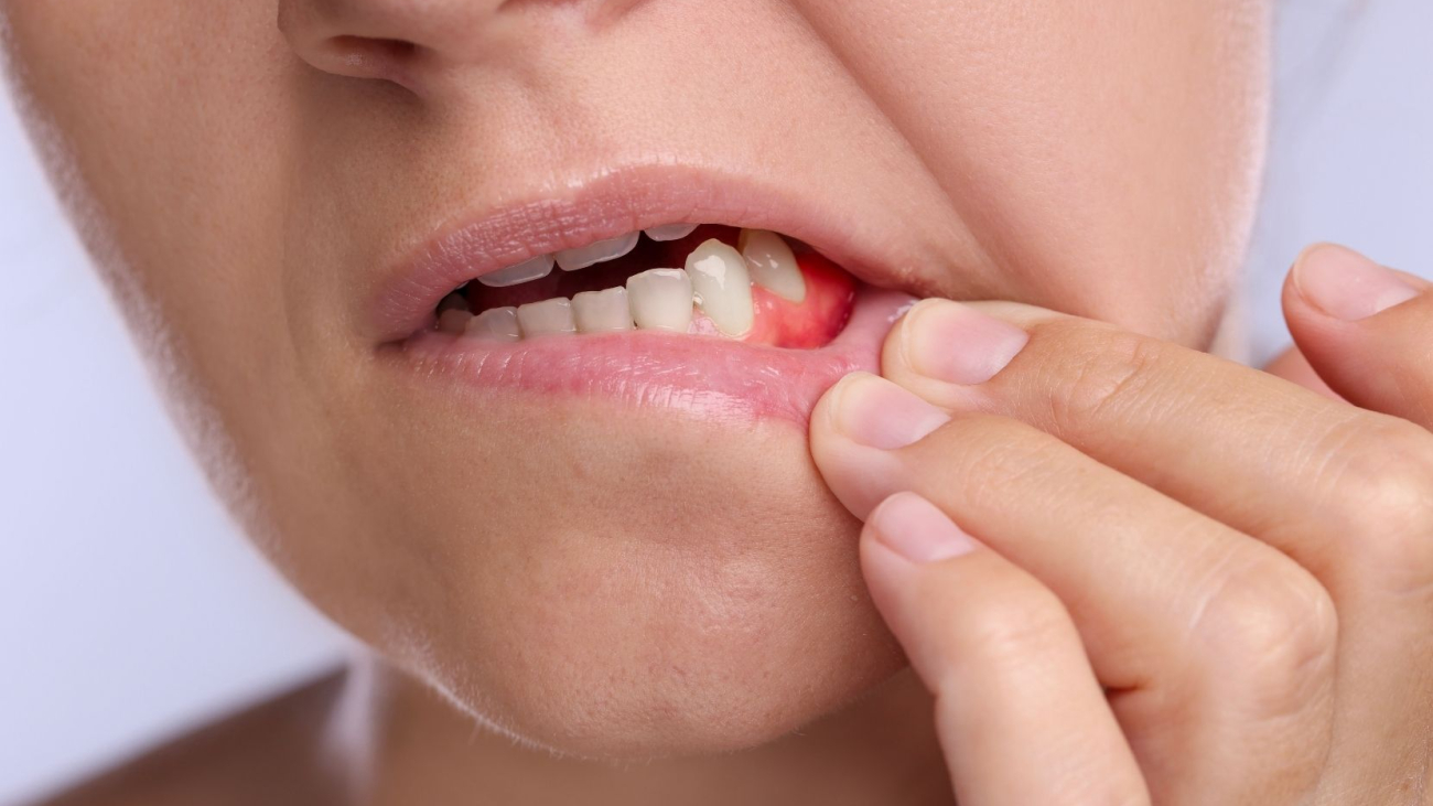 dis-eti-hastaliklarinin-erken-belirtileri-nelerdir