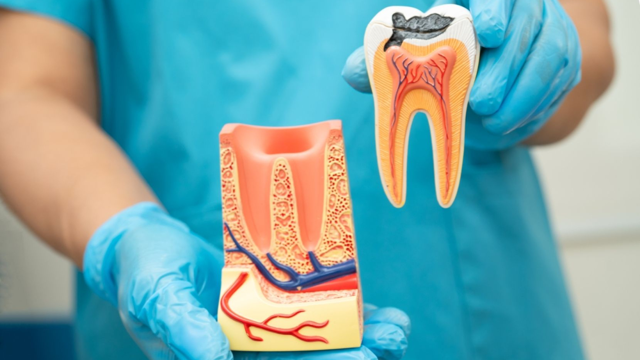 kanal-tedavisinden-sonra-dis-neden-agrir